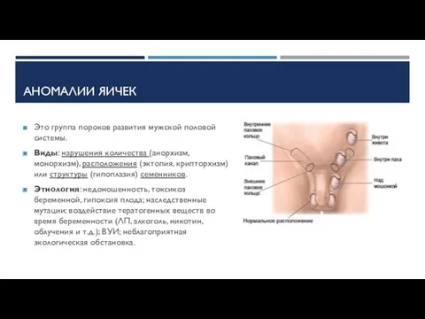 АНОМАЛИИ ЯИЧЕК Это группа пороков развития мужской половой системы. Виды: