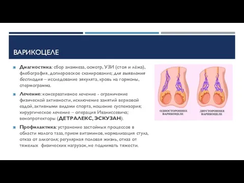 ВАРИКОЦЕЛЕ Диагностика: сбор анамнеза, осмотр, УЗИ (стоя и лёжа), флебография,