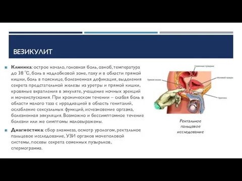 ВЕЗИКУЛИТ Клиника: острое начало, головная боль, озноб, температура до 38