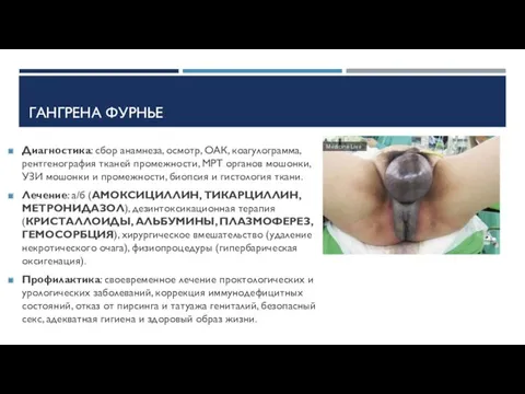 ГАНГРЕНА ФУРНЬЕ Диагностика: сбор анамнеза, осмотр, ОАК, коагулограмма, рентгенография тканей