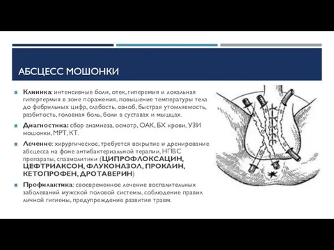 АБСЦЕСС МОШОНКИ Клиника: интенсивные боли, отек, гиперемия и локальная гипертермия