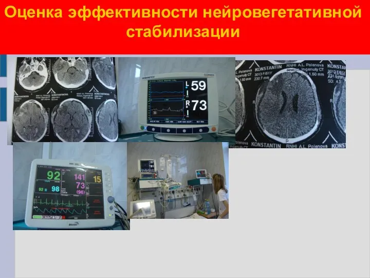 Оценка эффективности нейровегетативной стабилизации