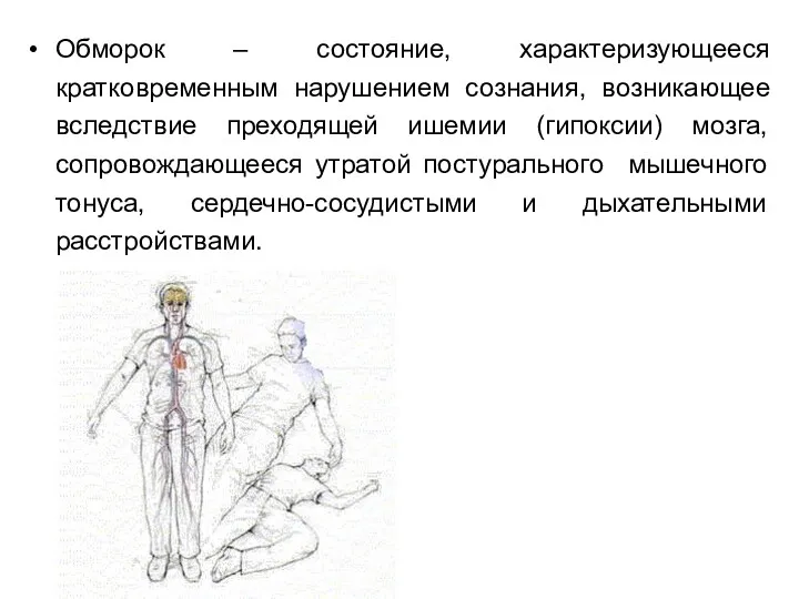 Обморок – состояние, характеризующееся кратковременным нарушением сознания, возникающее вследствие преходящей