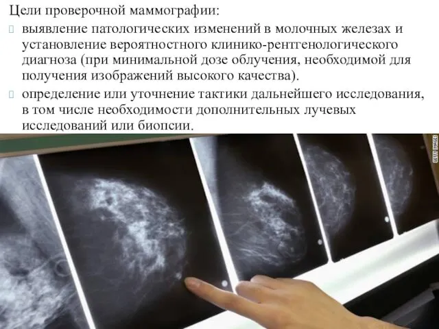 Цели проверочной маммографии: выявление патологических изменений в молочных железах и установление вероятностного клинико-рентгенологического