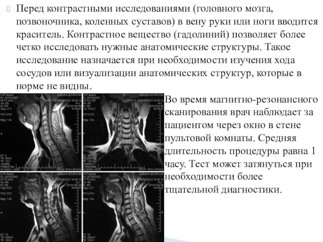 Перед контрастными исследованиями (головного мозга, позвоночника, коленных суставов) в вену руки или ноги
