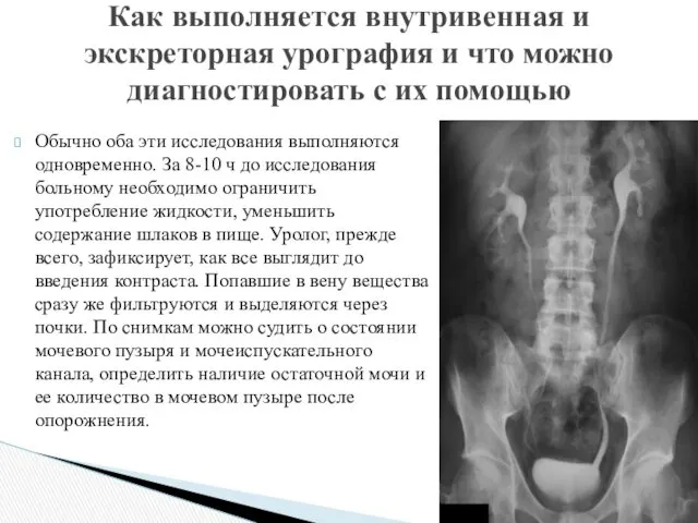 Обычно оба эти исследования выполняются одновременно. За 8-10 ч до