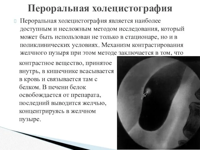 Пероральная холецистография является наиболее доступным и несложным методом исследования, который