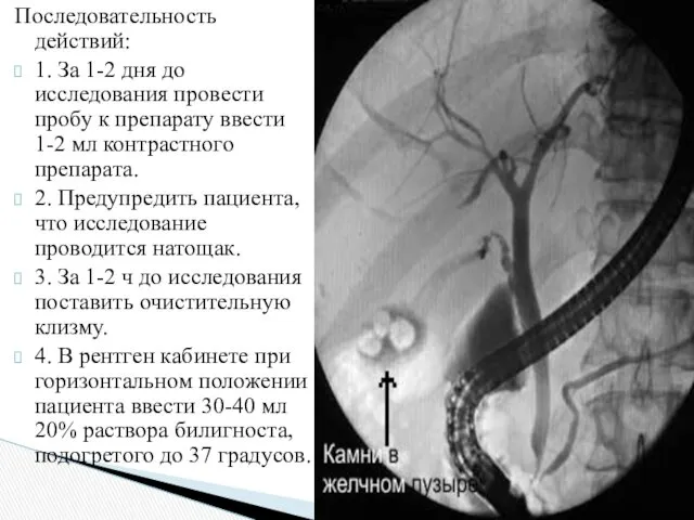 Последовательность действий: 1. За 1-2 дня до исследования провести пробу к препарату ввести