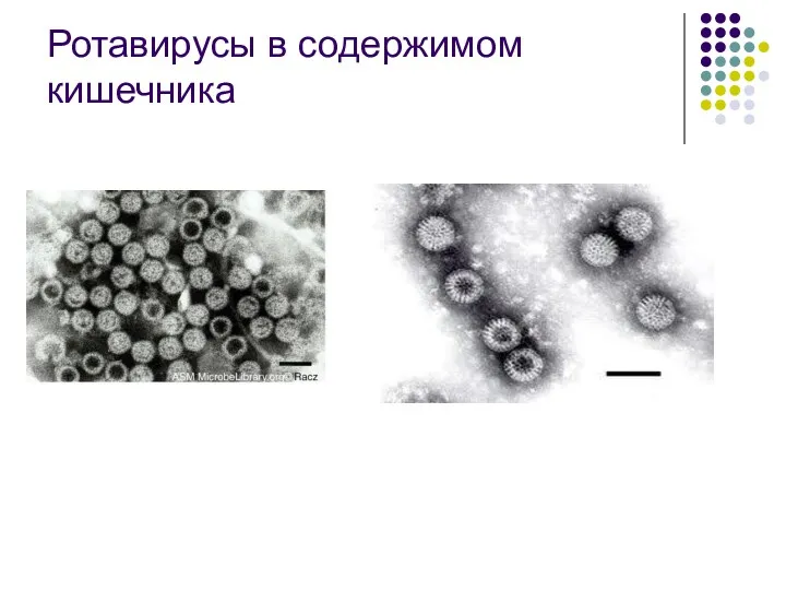 Ротавирусы в содержимом кишечника