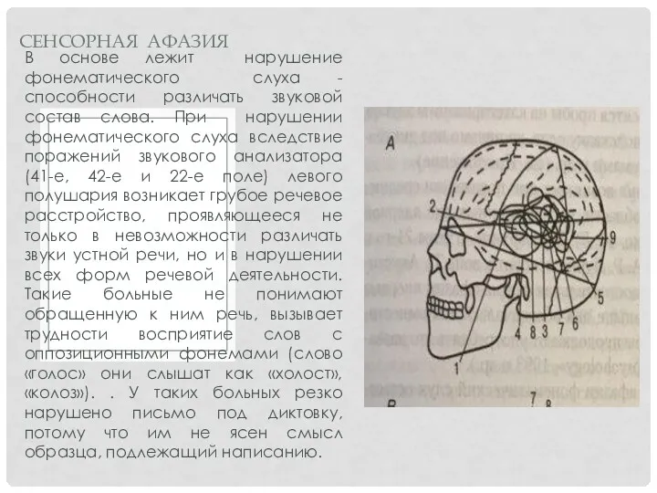 В основе лежит нарушение фонематического слуха - способности различать звуковой