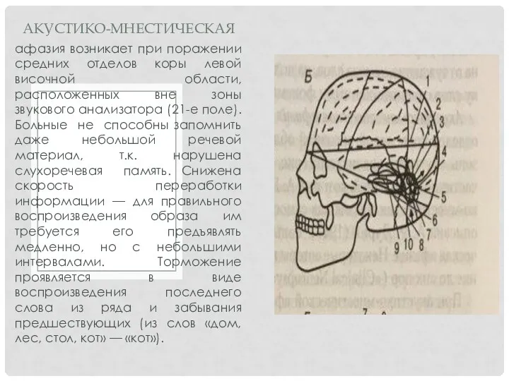 афазия возникает при поражении средних отделов коры левой височной области,