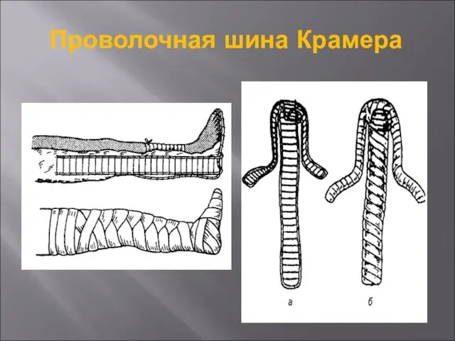 Проволочная шина Крамера