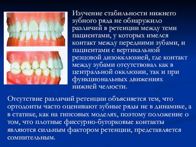 Изучение стабильности нижнего зубного ряда не обнаружило различий в ретенции