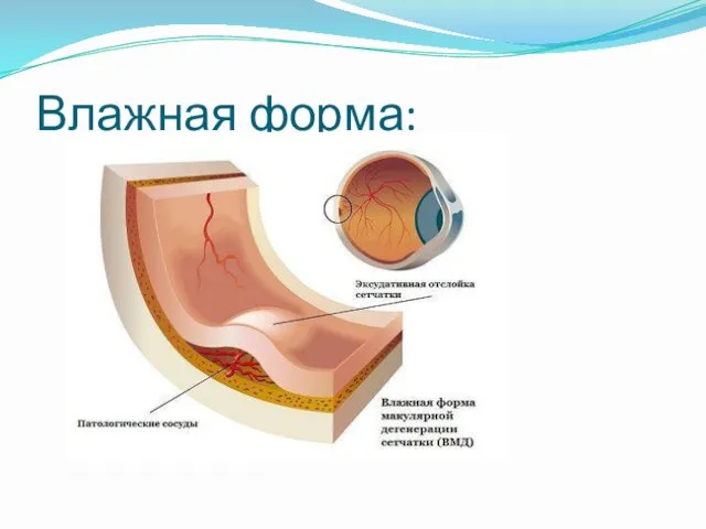 Влажная форма: