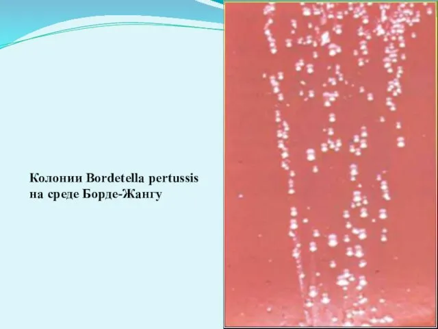 Колонии Bordetella pertussis на среде Борде-Жангу