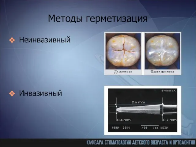 Методы герметизация Неинвазивный Инвазивный