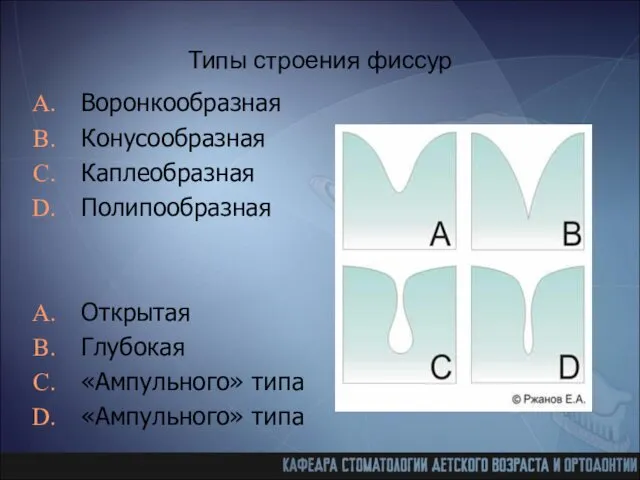 Типы строения фиссур Воронкообразная Конусообразная Каплеобразная Полипообразная Открытая Глубокая «Ампульного» типа «Ампульного» типа