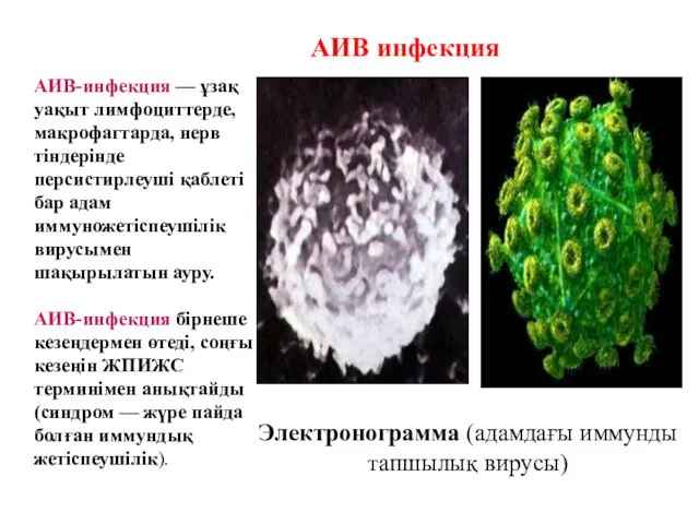 Электронограмма (адамдағы иммунды тапшылық вирусы) АИВ-инфекция — ұзақ уақыт лимфоциттерде, макрофагтарда, нерв тіндерінде