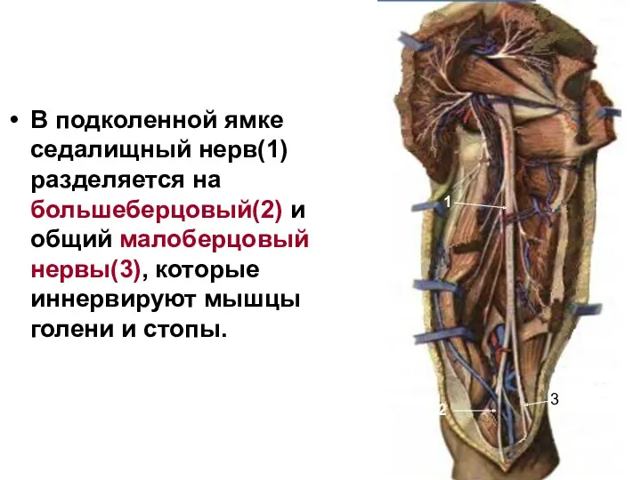 В подколенной ямке седалищный нерв(1) разделяется на большеберцовый(2) и общий малоберцовый нервы(3), которые