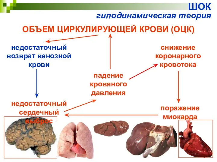 ШОК гиподинамическая теория