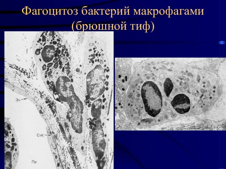 Фагоцитоз бактерий макрофагами (брюшной тиф)