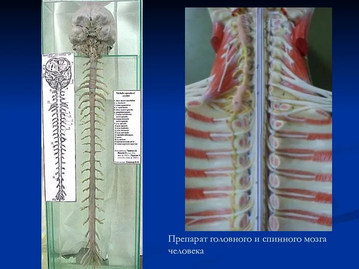 Препарат головного и спинного мозга человека