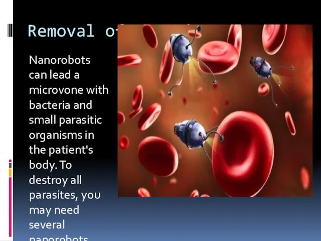 Removal of parasites. Nanorobots can lead a microvone with bacteria