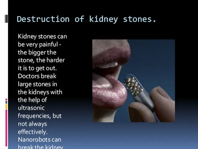 Destruction of kidney stones. Kidney stones can be very painful