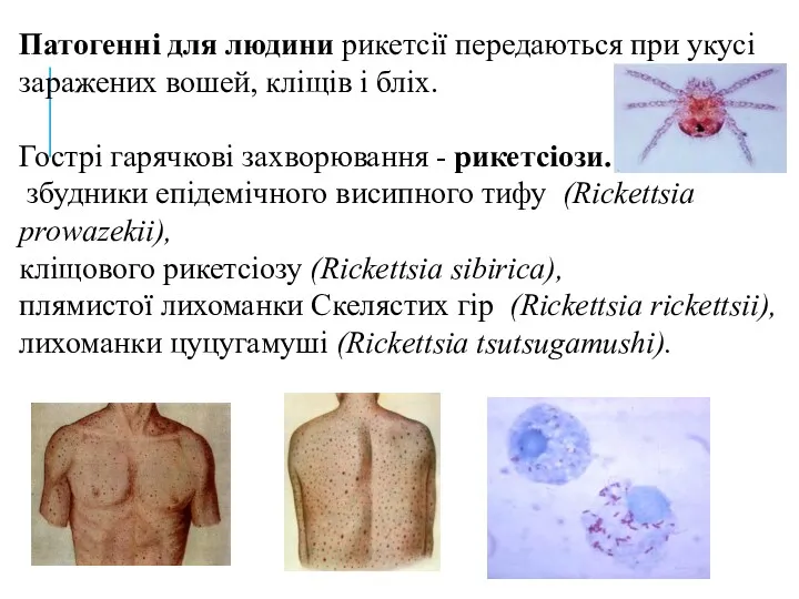 Патогенні для людини рикетсії передаються при укусі заражених вошей, кліщів