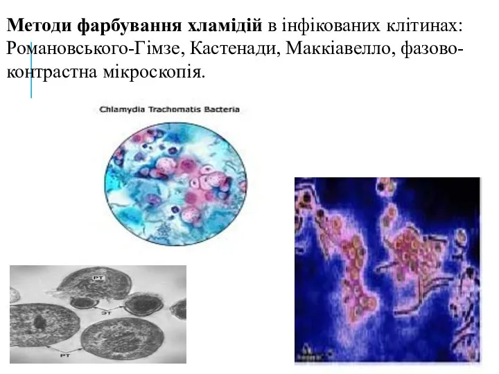 Методи фарбування хламідій в інфікованих клітинах: Романовського-Гімзе, Кастенади, Маккіавелло, фазово-контрастна мікроскопія.