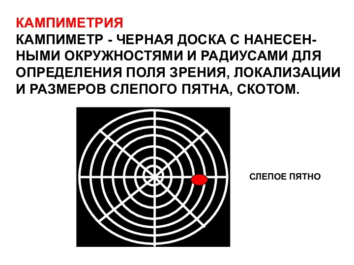 КАМПИМЕТРИЯ КАМПИМЕТР - ЧЕРНАЯ ДОСКА С НАНЕСЕН- НЫМИ ОКРУЖНОСТЯМИ И РАДИУСАМИ ДЛЯ ОПРЕДЕЛЕНИЯ