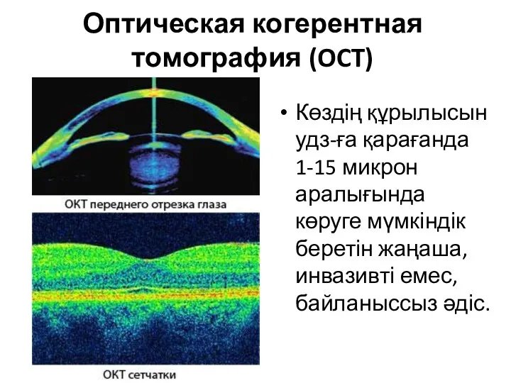 Оптическая когерентная томография (OCT) Көздің құрылысын удз-ға қарағанда 1-15 микрон