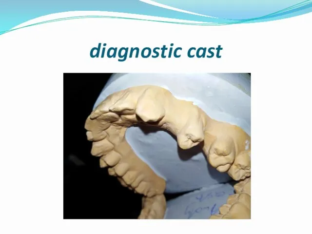 diagnostic cast