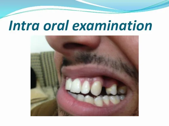 Intra oral examination