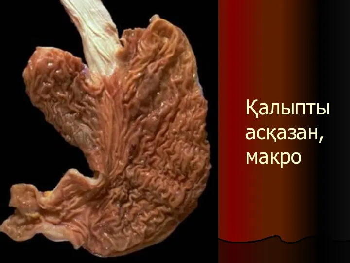 Қалыпты асқазан, макро