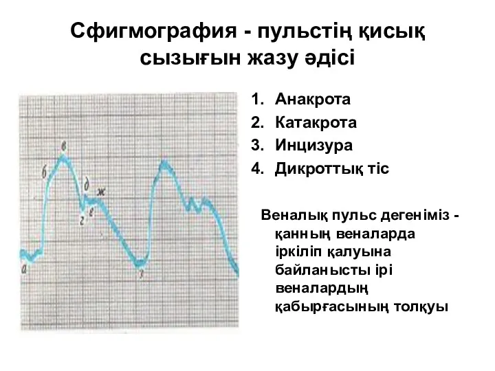 Сфигмография - пульстің қисық сызығын жазу әдісі Анакрота Катакрота Инцизура