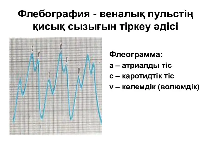 Флебография - веналық пульстің қисық сызығын тіркеу әдісі Флеограмма: а