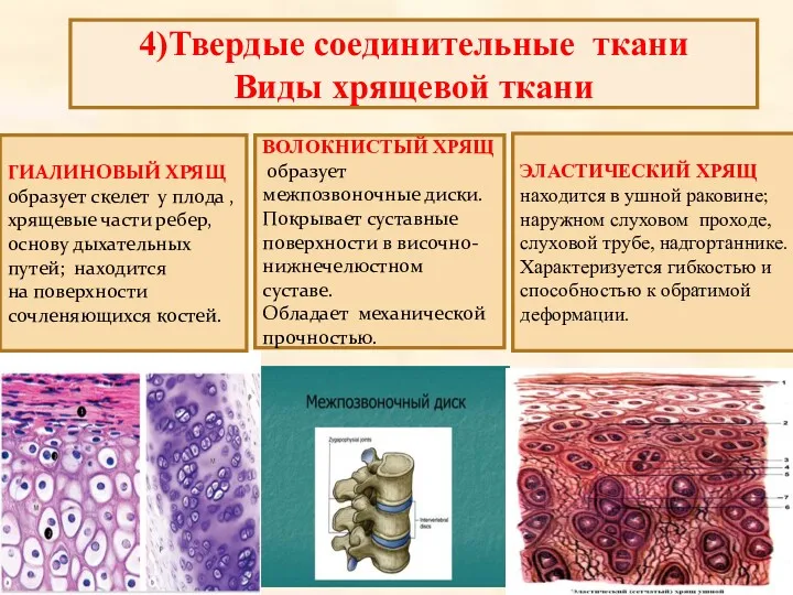 Виды хрящевой ткани ГИАЛИНОВЫЙ ХРЯЩ образует скелет у плода ,