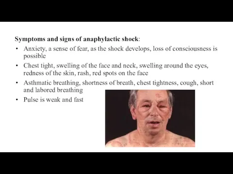 Symptoms and signs of anaphylactic shock: Anxiety, a sense of