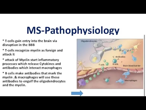 MS-Pathophysiology * T-cells gain entry into the brain via disruption in the BBB