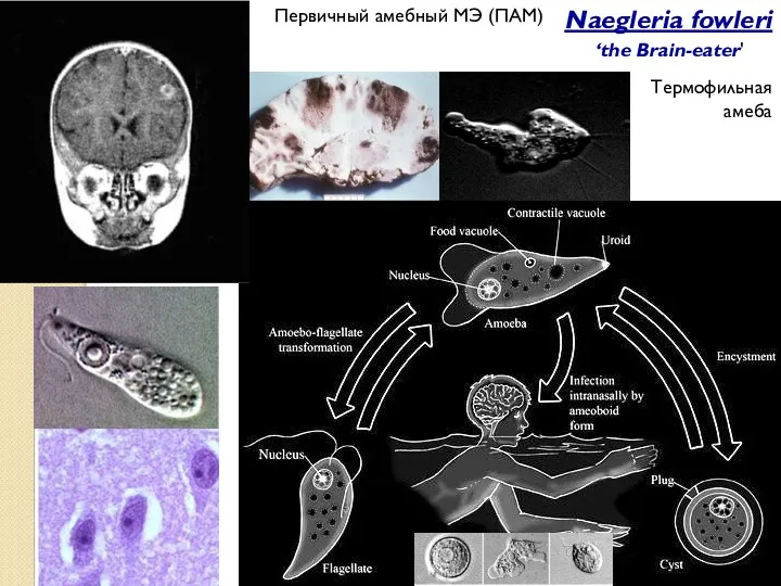 Первичный амебный МЭ (ПАМ) Naegleria fowleri the Brain-eater' ‘the Brain-eater' Термофильная амеба