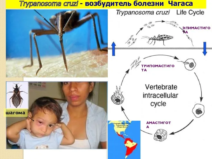 ЭПИМАСТИГОТА ТРИПОМАСТИГОТА АМАСТИГОТА шагома Trypanosoma cruzi - возбудитель болезни Чагаса