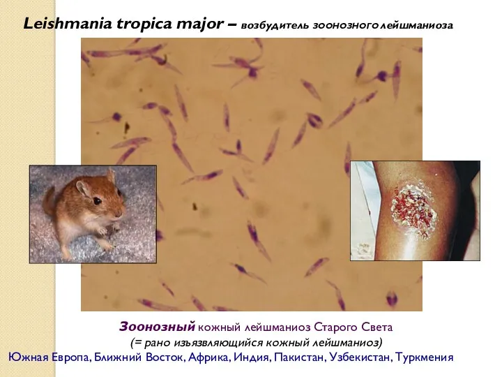 Leishmania tropica major – возбудитель ЗООНОЗНОГО лейшманиоза Зоонозный кожный лейшманиоз