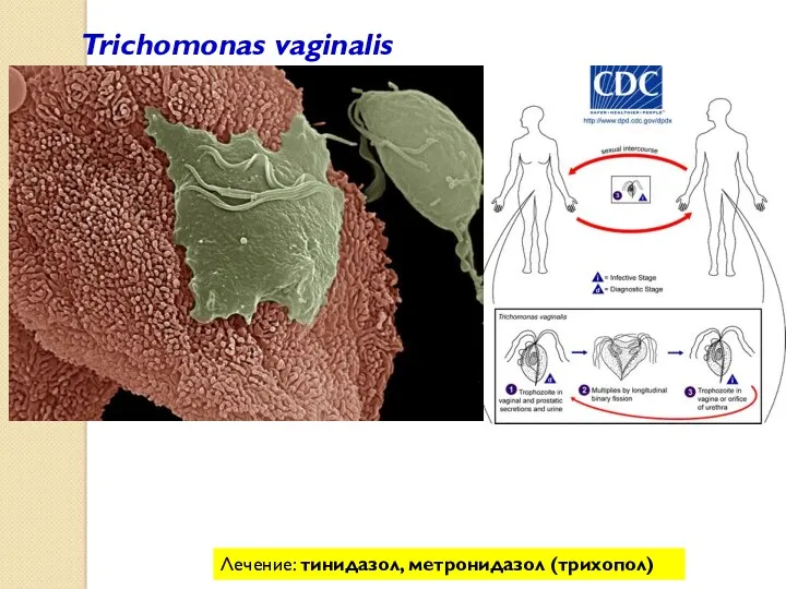 Trichomonas vaginalis Лечение: тинидазол, метронидазол (трихопол)