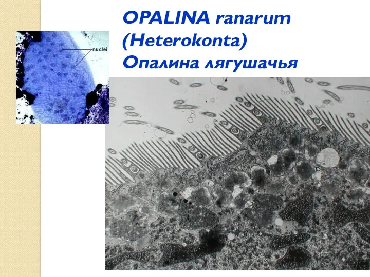 OPALINA ranarum (Heterokonta) Опалина лягушачья