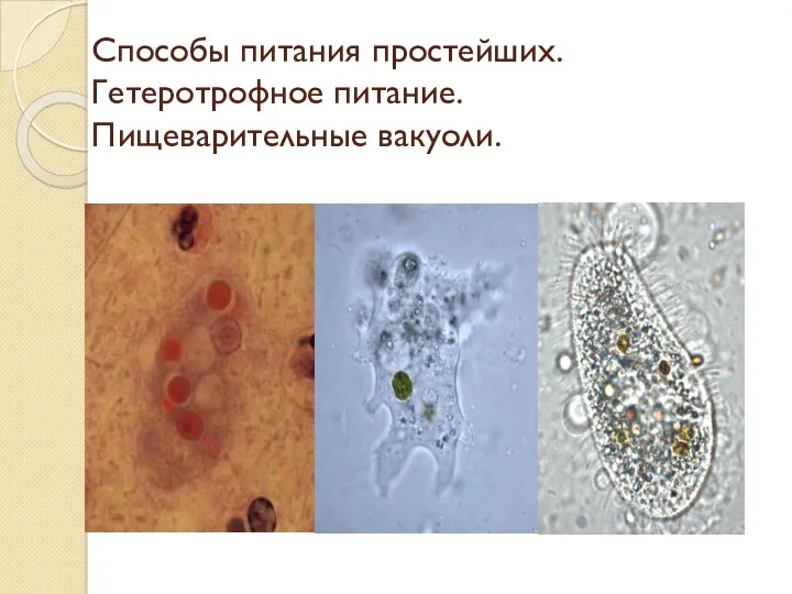 Способы питания простейших. Гетеротрофное питание. Пищеварительные вакуоли.