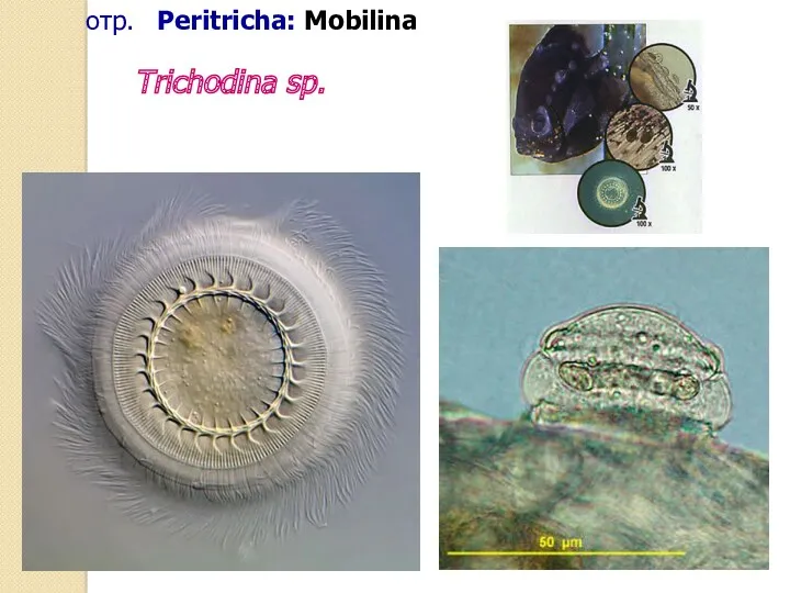 отр. Peritricha: Mobilina Trichodina sp.