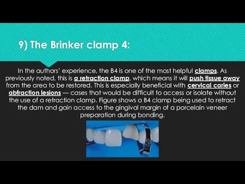 9) The Brinker clamp 4: In the authors’ experience, the