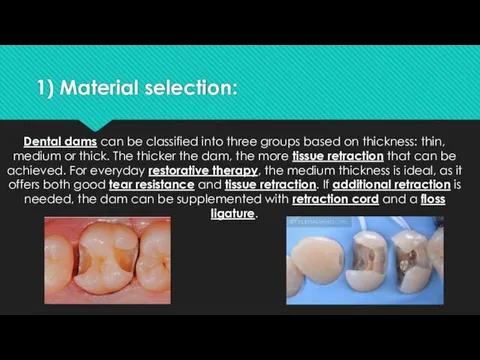 1) Material selection: Dental dams can be classified into three