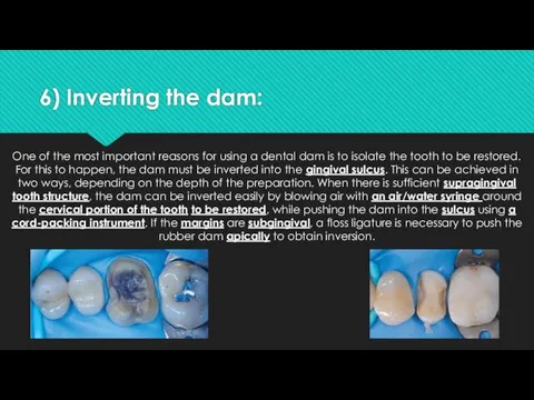 6) Inverting the dam: One of the most important reasons